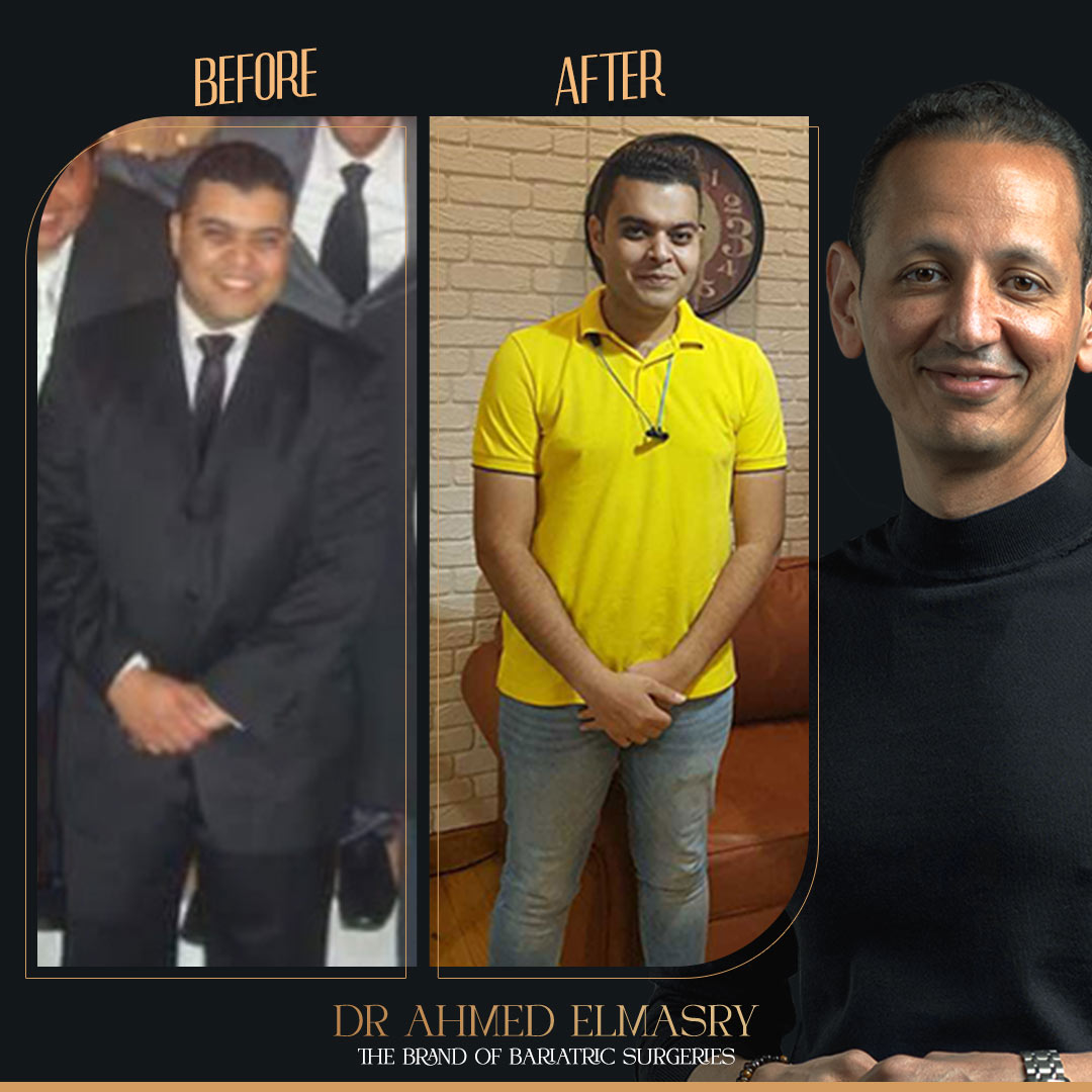 تجربتي مع تحويل المسار